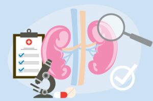 kidney Disease Diagnosis 1366379079 770x533 1 650x428