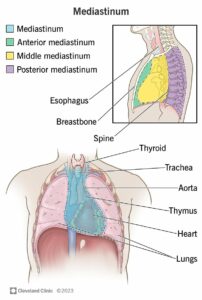 13792 mediastinal tumors