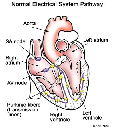 Tavaline elektrisüsteemi rada surub verd läbi südame ja välja ülejäänud kehasse.