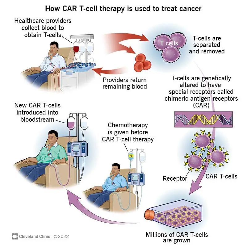 17726 car t cell therapy