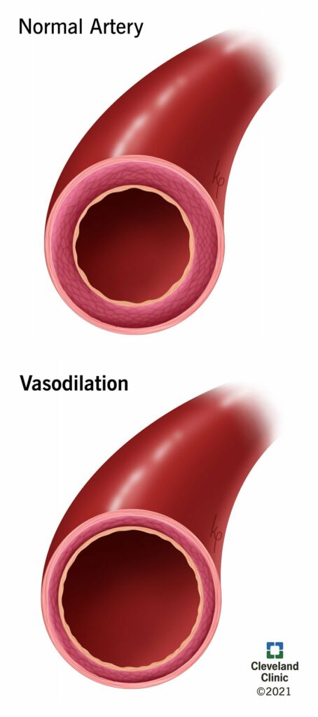 23352 vasodilation illustration