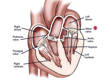 mvr 01 inside heart mitral