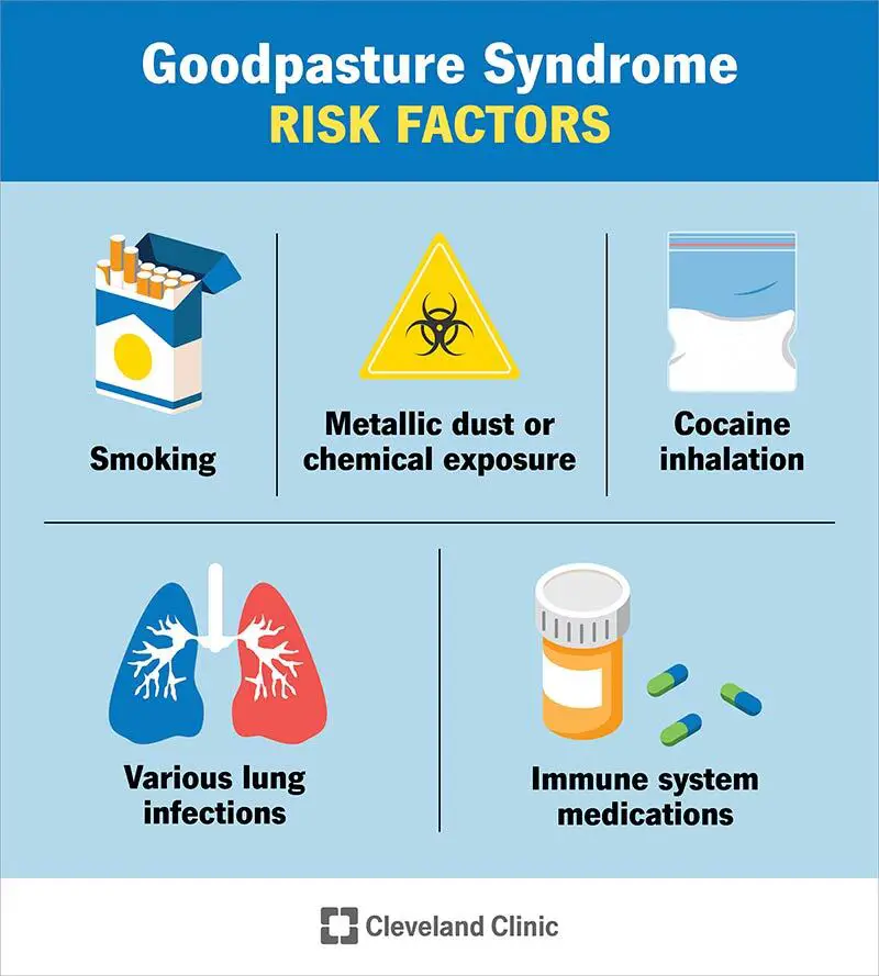 1705261638 5927 goodpasture syndrome