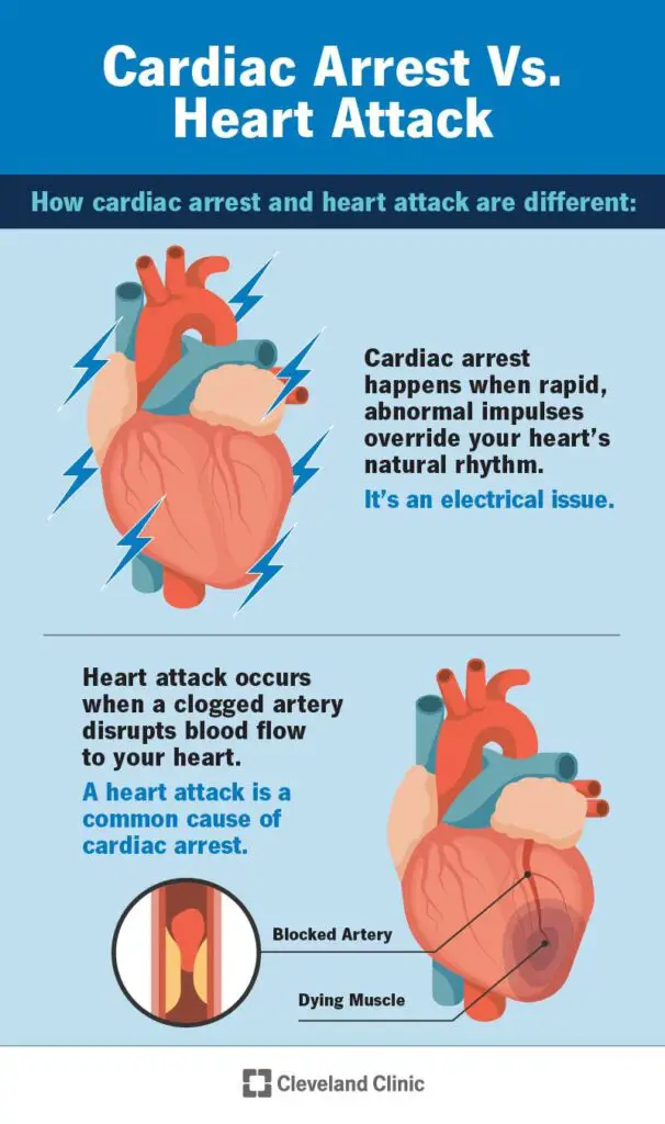 1706055679 21736 cardiac arrest vs heart attack