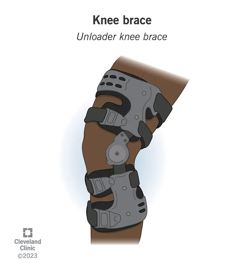 1706058320 knee brace