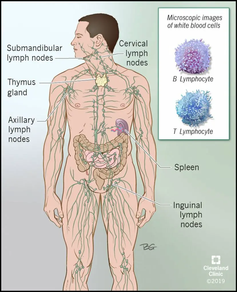 17920 castleman disease