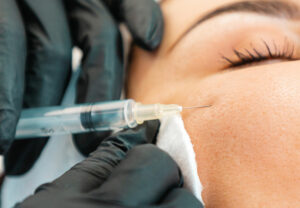 dermalFillers 1326975631 770x533 2