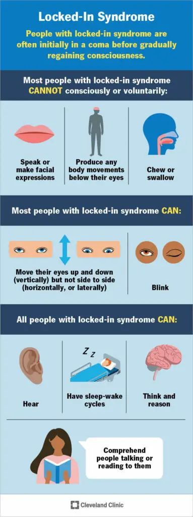 1706850144 22462 locked in syndrome