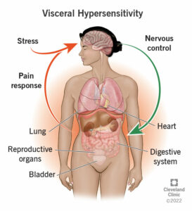 1708350323 22997 visceral hypersensitivity