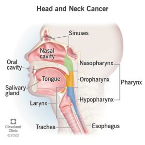 1709121387 14458 head and neck cancer