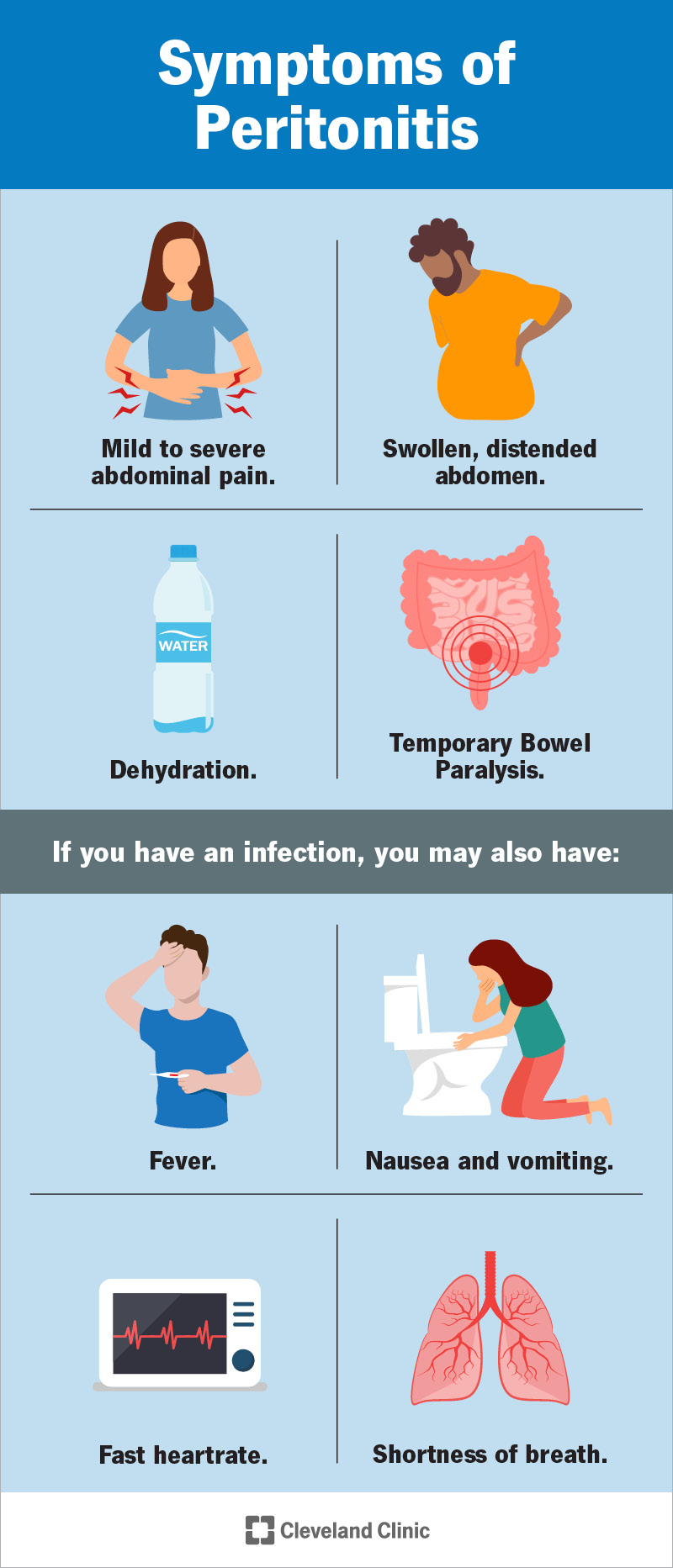 Peritoniidi sümptomiteks on kõhuvalu ja turse.