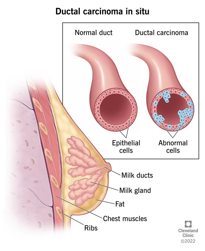 Vähieelsed rakud moodustuvad rinna sees olevates piimakanalites.