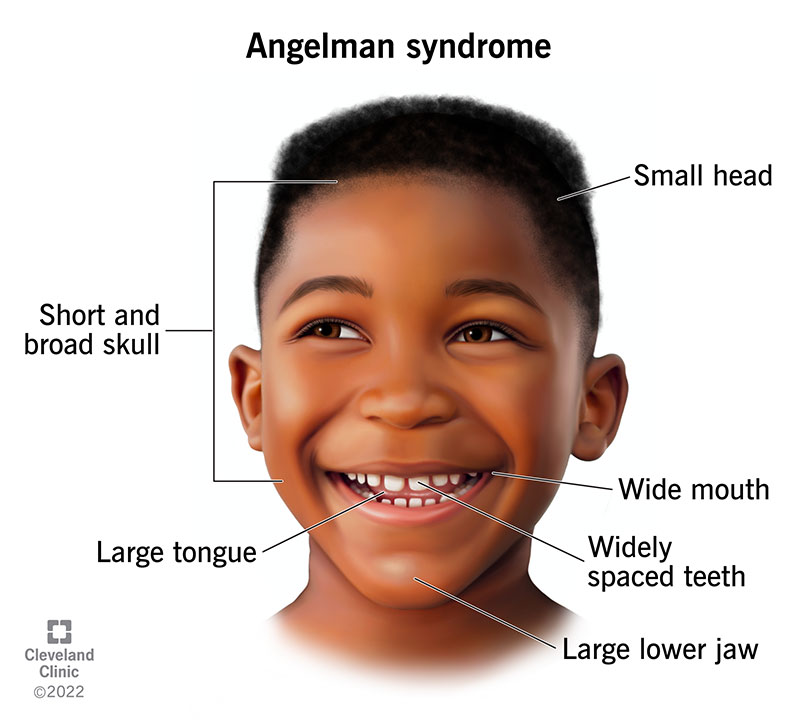 Eristavad näoomadused, sealhulgas lühike ja lai kolju, laiaulatuslikud hambad ja ebatavaliselt suur keel.