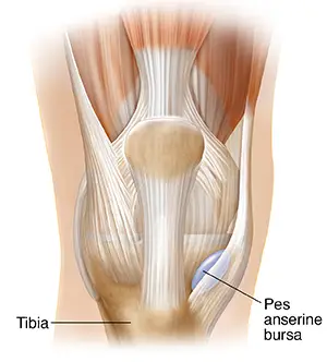 Pes Anserinuse bursiit