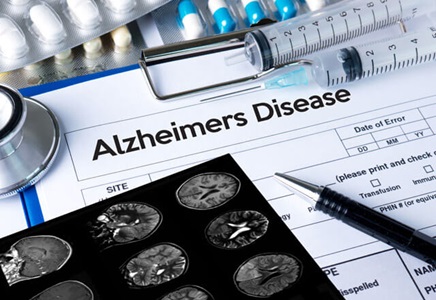 Alzheimeri tõve ravivormid ja ravimid