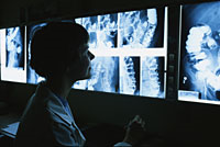 Pilt arstist, kes vaatab baariumklistiiri röntgenfilme