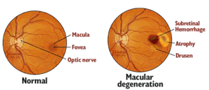 mdterms