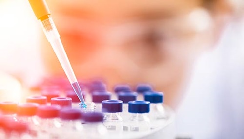 Koroonaviirus imikute ja laste seas | SFOMC 5 Teadlane sisestab pipeti ettevaatlikult katseklaasi.