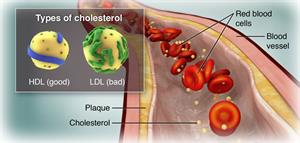 Kolesterooli tüübid, HDL (hea) ja LDL (halb)