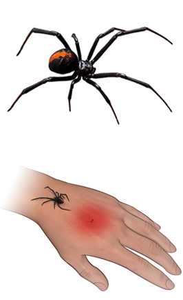 Black Widow ämblik ja hammustus