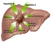 causesofhepatocellularcarcinoma290444