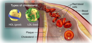 cholesterolinthebloodstream323361.ashx