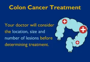 colon cancer treatment2