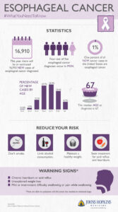 esophagealcancerinfographic