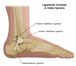 ligamentsinvolvedinanklesprains