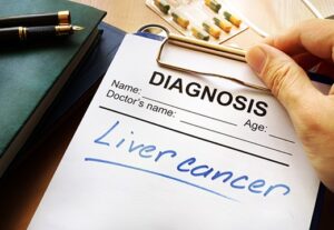 liver cancer spread