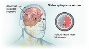 Staatus Epilepticus Krambid